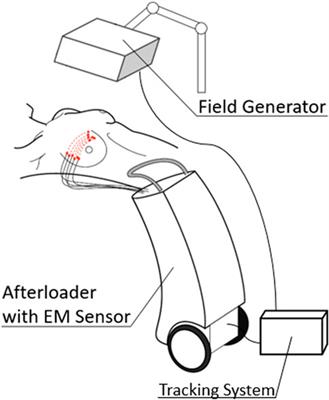 Electromagnetic tracking in interstitial brachytherapy: A systematic review